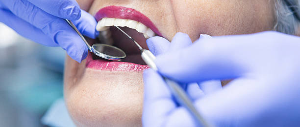 Best Emergency Dental Filling Replacement  in Locust Grove, GA